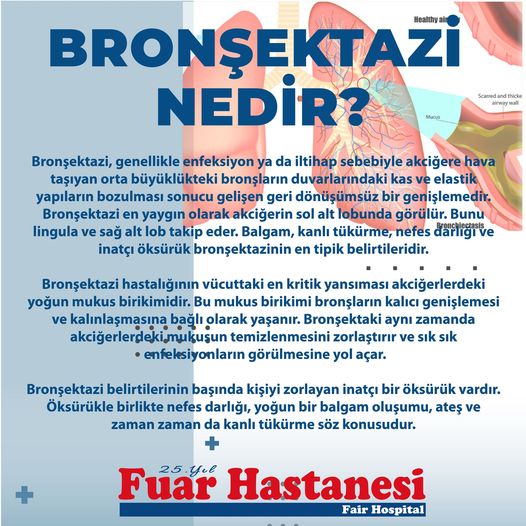 Bronşektazi: Solunum Hastalığı ve Belirtileri